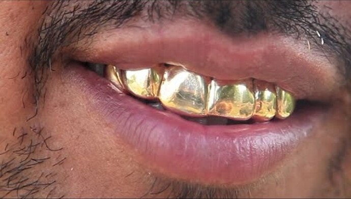 Des-dents-en-or